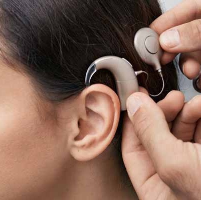 Cochlear implantat